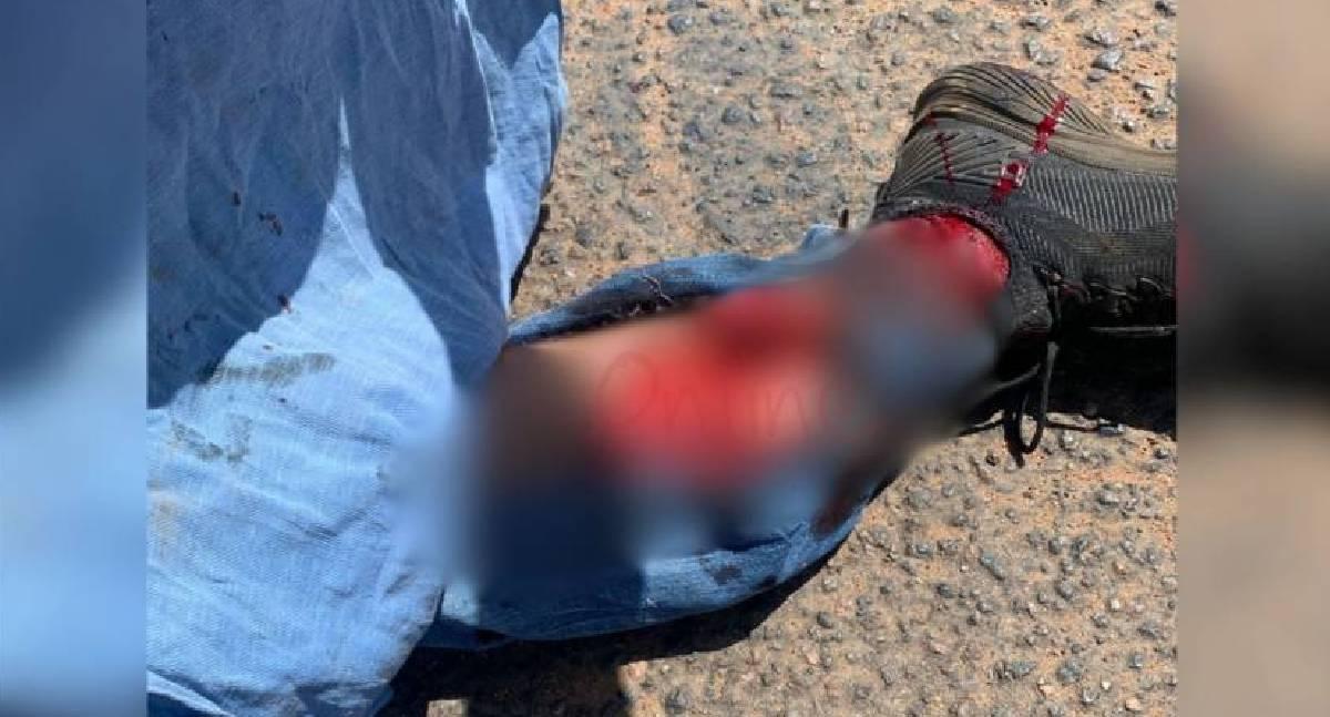 Comerciante tem perna dilacerada em acidente com carro em Rondônia